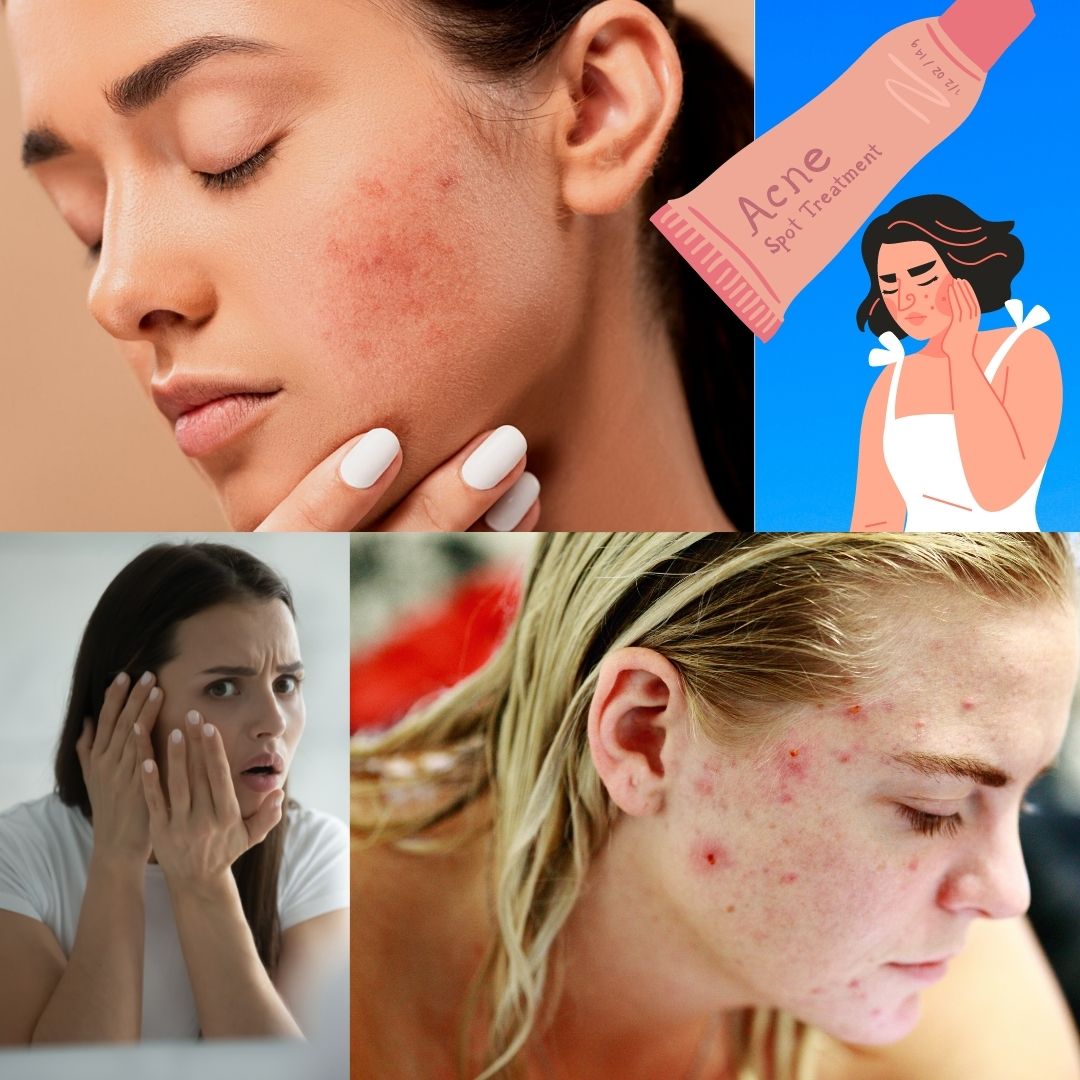 Bad Skin
